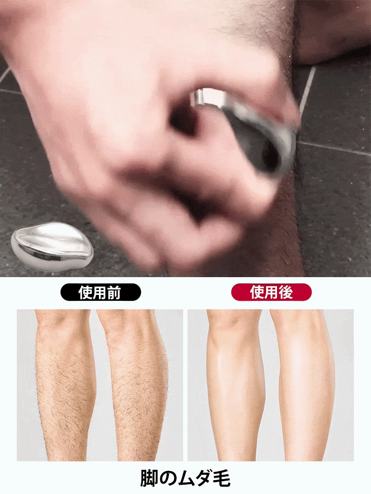 無痛除毛・角質オフつるつるガラス脱毛器